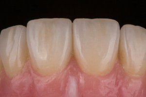 centrales superiores PicsArt_1360341651073